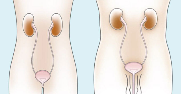 diagram of the female and male urinary systems