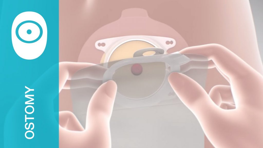 Purchase Ostomy Supplies Comfort Medical 8007004246